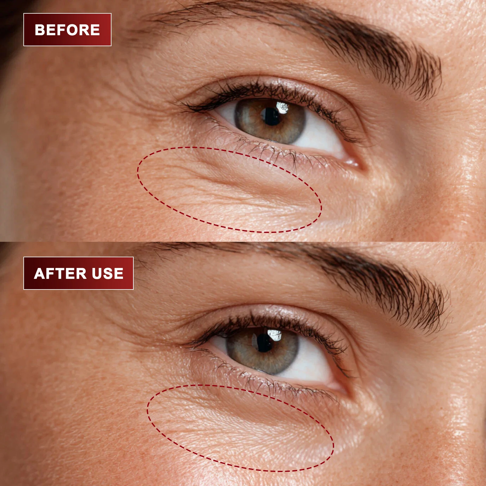 Paquete de 5 Cremas para Ojos  - The Ordinary Serum Hyaluronic Acid reseña y precio